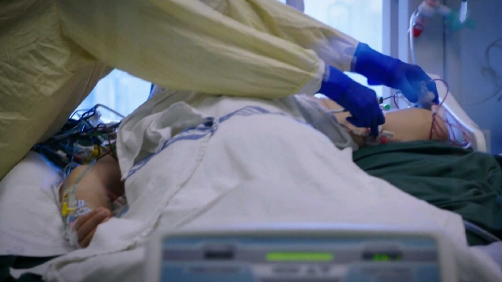 Saskatchewan ICUs are being pushed to the brink as COVID-19 hospitalizations hit record highs. 
